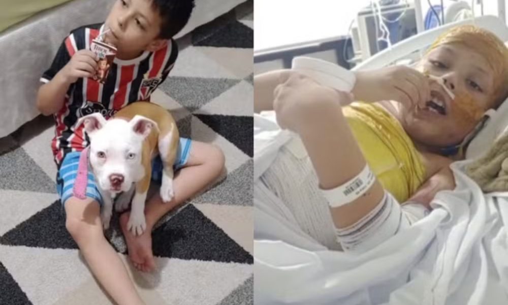 ‘Deus tem um plano na vida dele’: menino sobrevive a choque de 25 mil volts