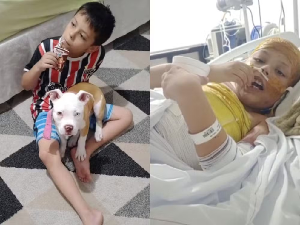 ‘Deus tem um plano na vida dele’: menino sobrevive a choque de 25 mil volts