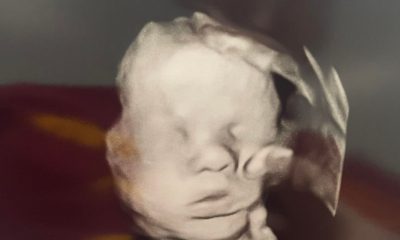 Cristã mostra a “mão de Deus” sobre seu filho em imagem de ultrassom